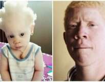 15 fotos mostrando a beleza peculiar de pessoas albinas