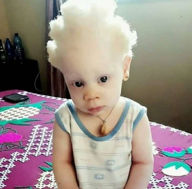 Fotos mostrando a beleza peculiar de pessoas albinas