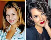 10+ celebridades brasileiras que assumiram ter “corrigido” seus rostos com intervenções externas