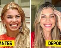19 famosos brasileiros que trataram dos dentes e ganharam sorrisos fantásticos