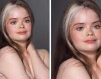 Conheça Jessica, uma modelo com síndrome de Down que promove a beleza sem estereótipo