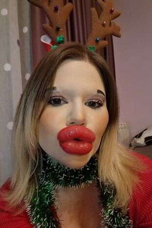 Mulher com os maiores lábios do mundo leiloa seus beijos no Natal
