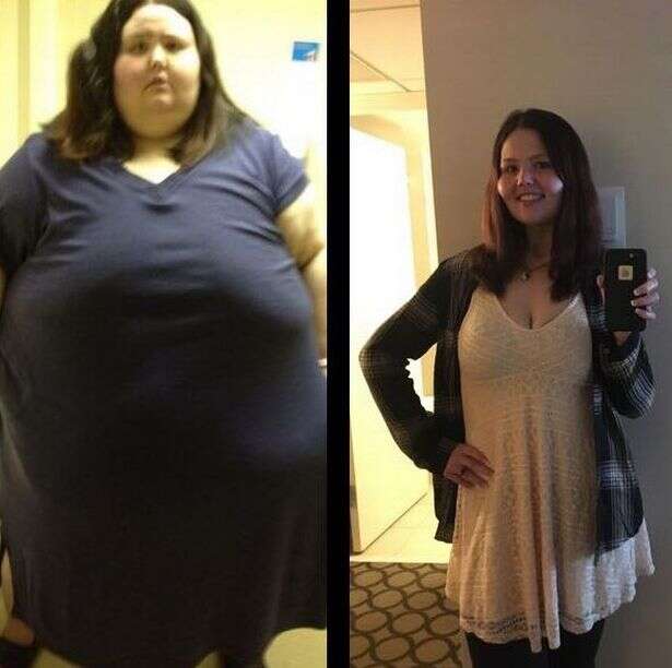 Uma das mulheres mais gordas do mundo fica irreconhecível após perder 227 quilos