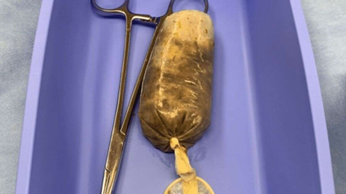 Homem em ataque de raiva engole banana inteira dentro de preservativo e vai parar no hospital