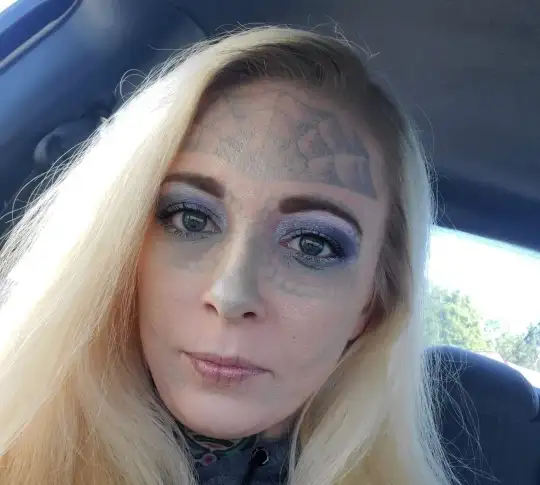Mulher com rosto de caveira remove tatuagem e fica totalmente diferente