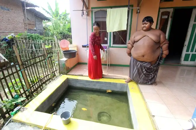 Menino mais gordo do mundo mostra superação e começa a emagrecer