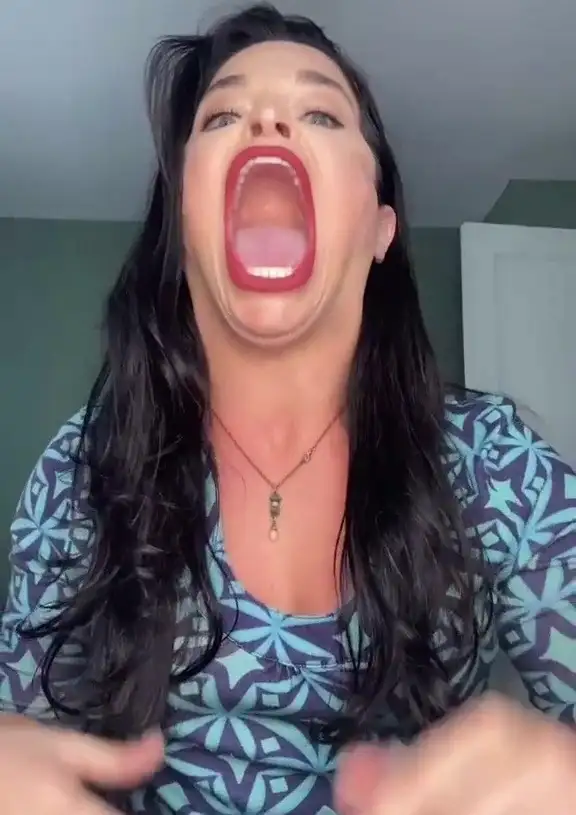 Mulher com a maior boca do mundo se aceita após anos de intimidações