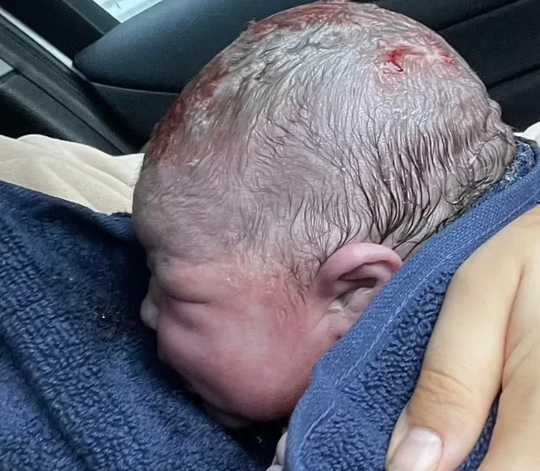 Mulher dá à luz no carro enquanto parceiro dirigia rumo ao hospital